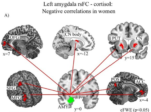 amigdala stress depressione donne