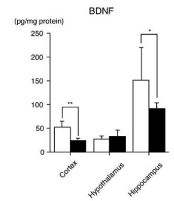 connessione cervello intestino esperimenti