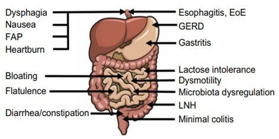 connessione cervello intestino irritabile