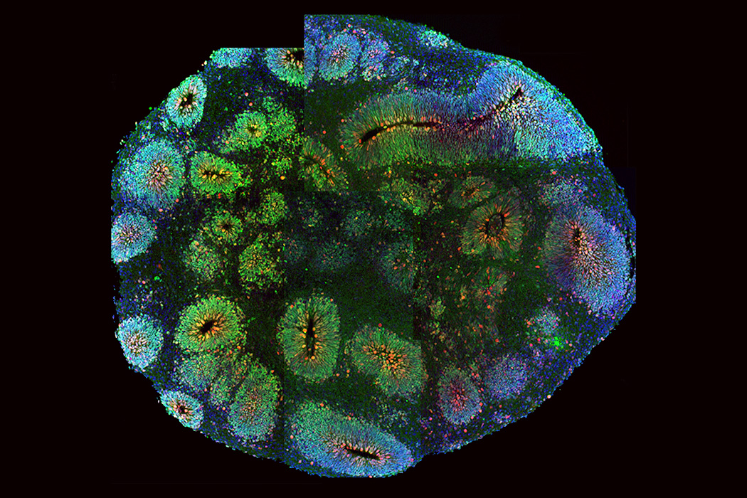 cervello sistema immunitario