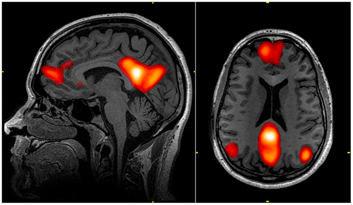 trauma psicologico memoria